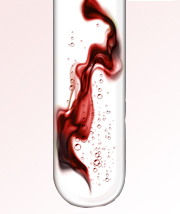 Pruebas Diagnósticas. Pruebas de laboratorio. Proteinograma