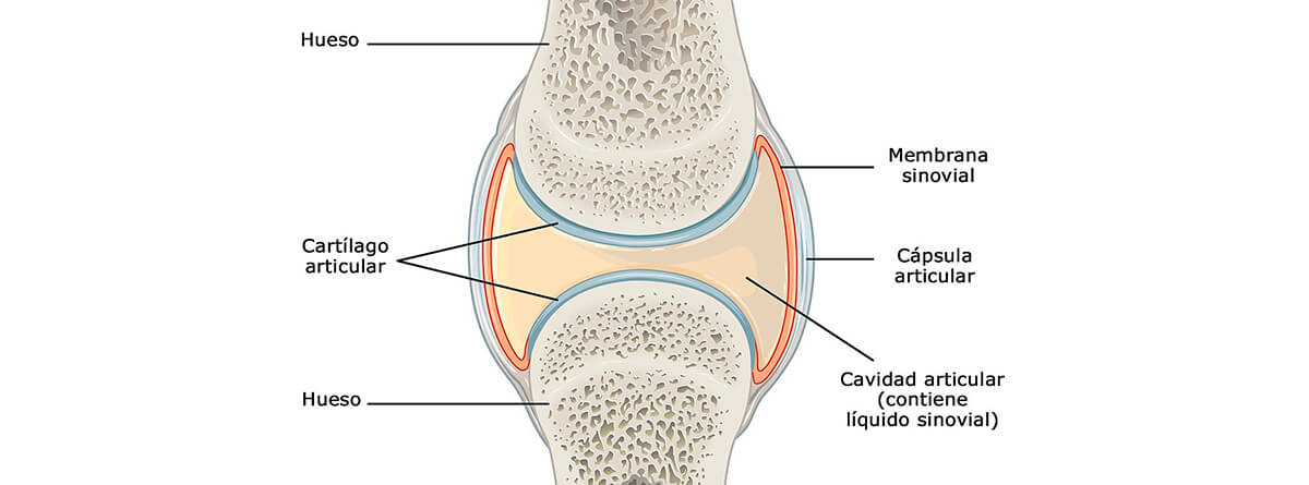 capsulitis articular de los dedos