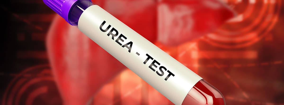 Muestra de sangre para prueba de urea. 