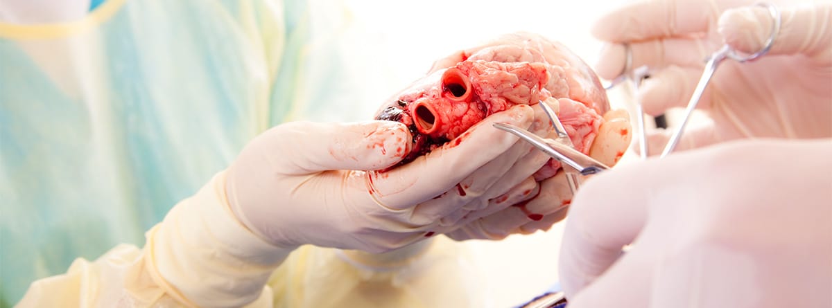 Trasplante y donación de órganos: especialista con un corazón en las manos