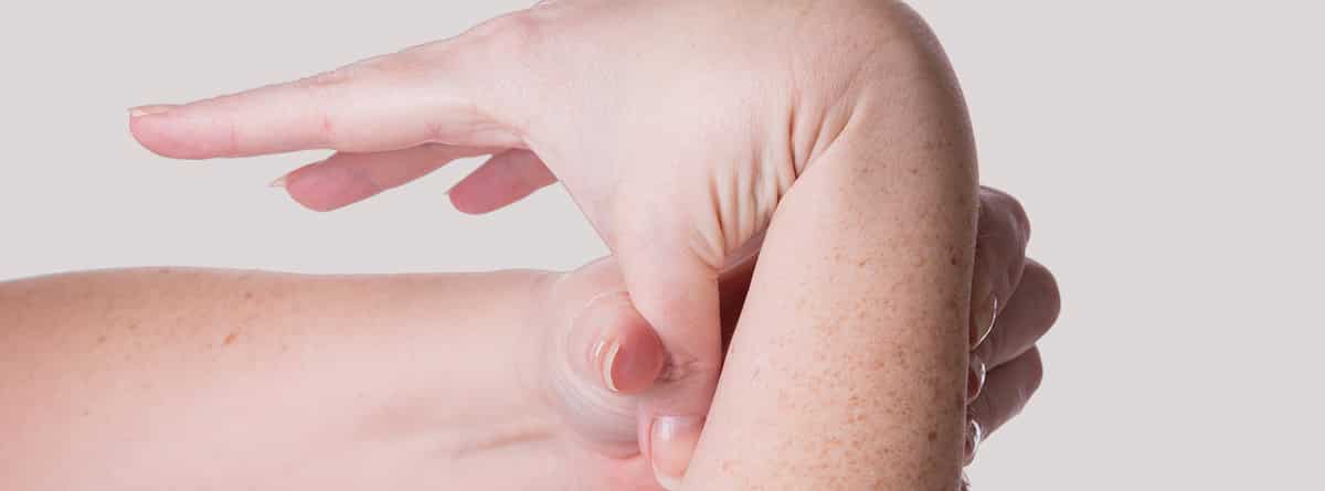 Síndrome de Ehlers-Dones:doblando el dedo gordo de una mano hacía el brazo