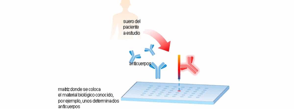 Diagnóstico por microarrays: dibujo explicando la realización de la muestra