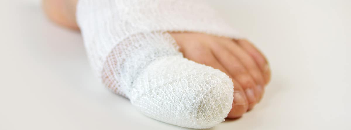 dedo gordo del pie vendado