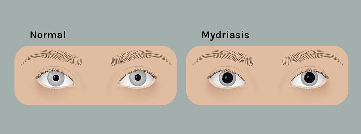 Ojos humanos normales realistas y con midriasis