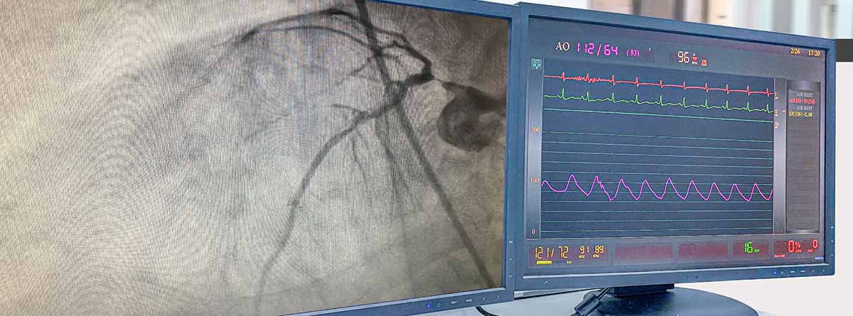 Fluoroscopia análisis en laboratorio