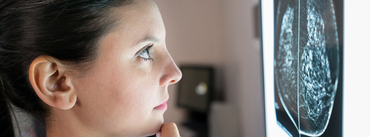 mujer médico mirando una mamografía para diagnóstico