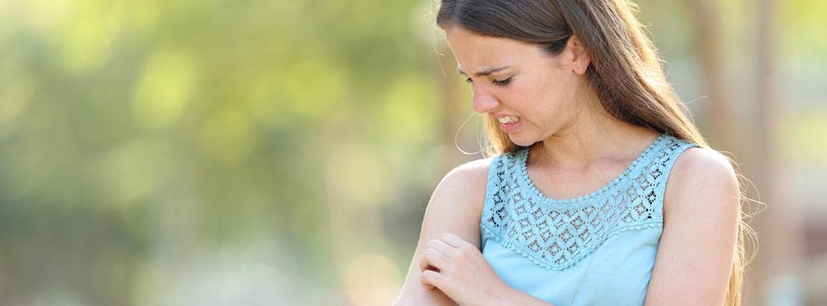 Chica con cara de dolor por una picadura de mosquito