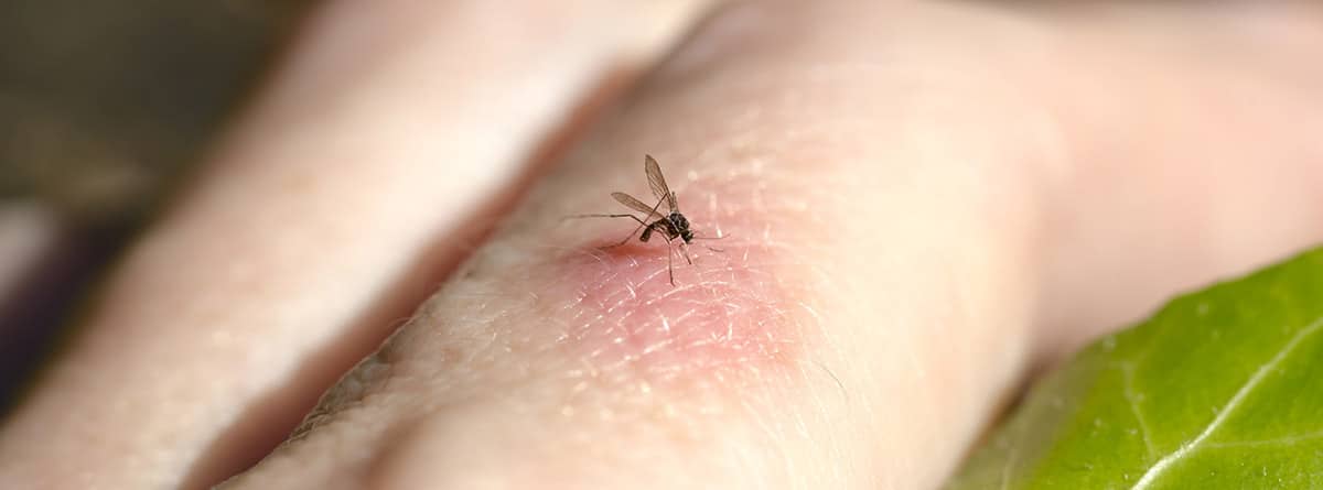 Mosquito picando a una persona