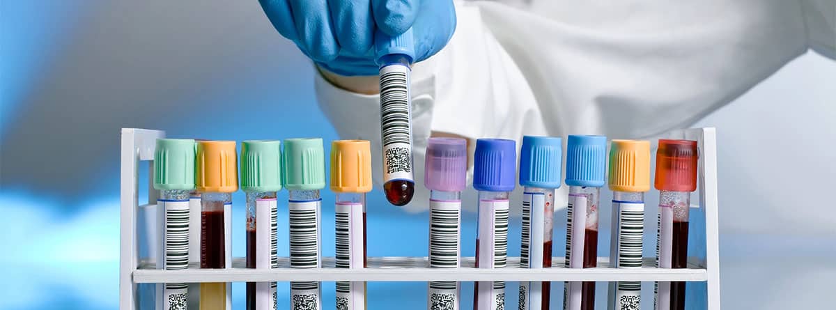 Prueba de sangre laboratorio