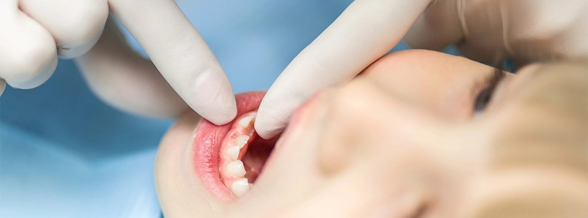 Niño con dientes temporales en consulta del dentista