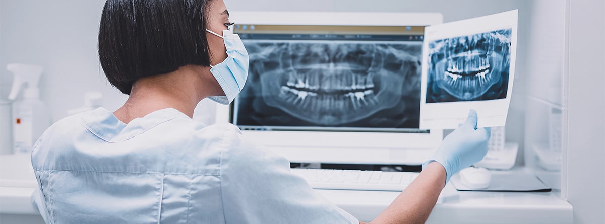 radiografía de mandibula