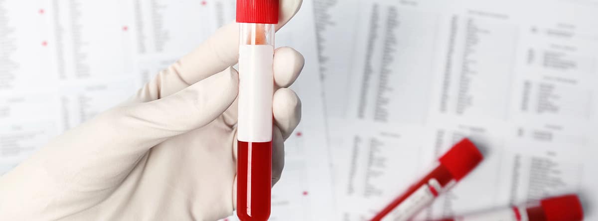 Prueba de sangre