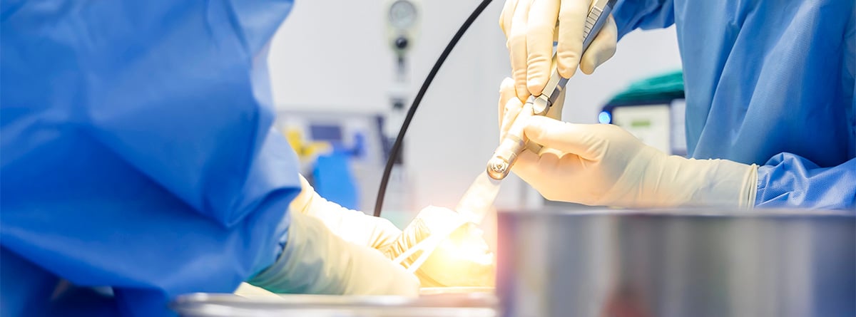 Operación de juanetes