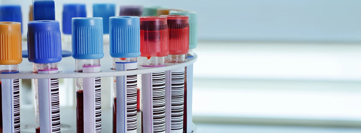 tubos de análisis de sangre