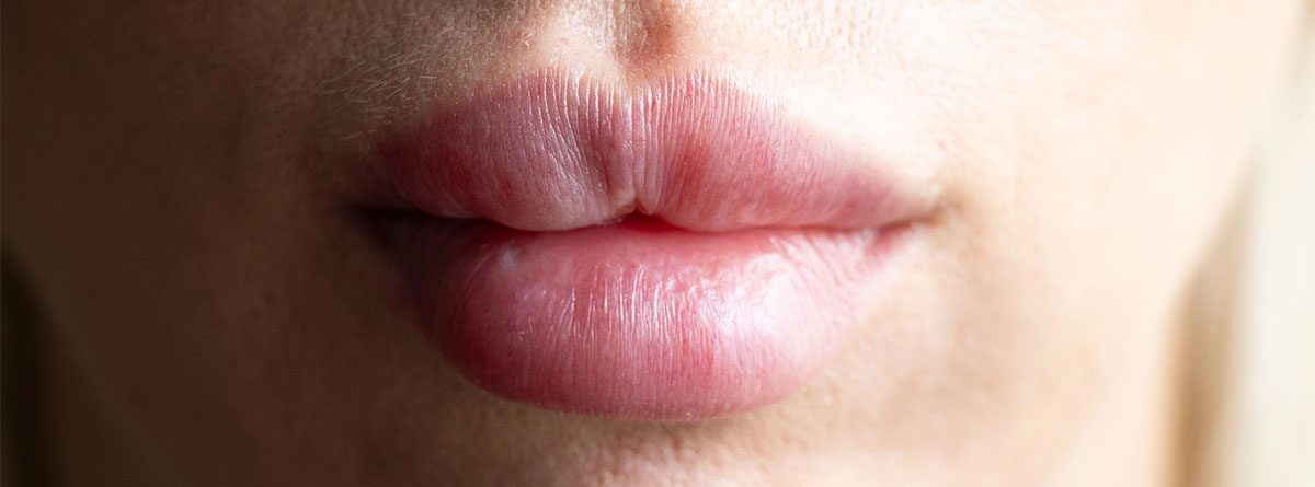 Labios asimétricos de mujer