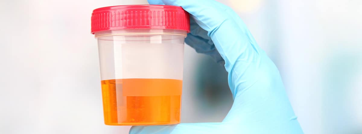 Bote de muestra de orina