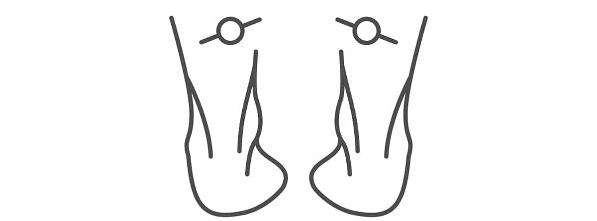 Ilustración pisada tipo supinador