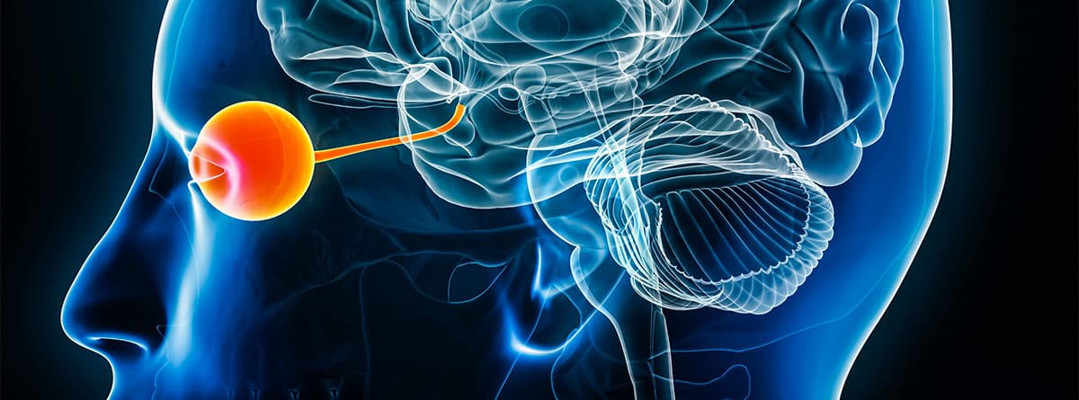 Ilustración 3D neuritis óptica
